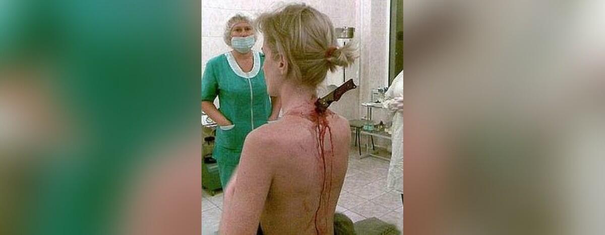 Mujer rusa camina a casa con un cuchillo clavado en la espalda sin percatarse