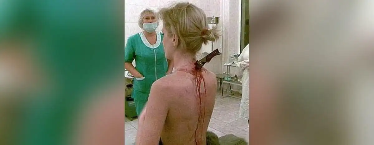 Mujer rusa camina a casa con un cuchillo clavado en la espalda sin percatarse