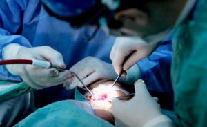 Operaciones-a-pacientes-con-labio-leporino