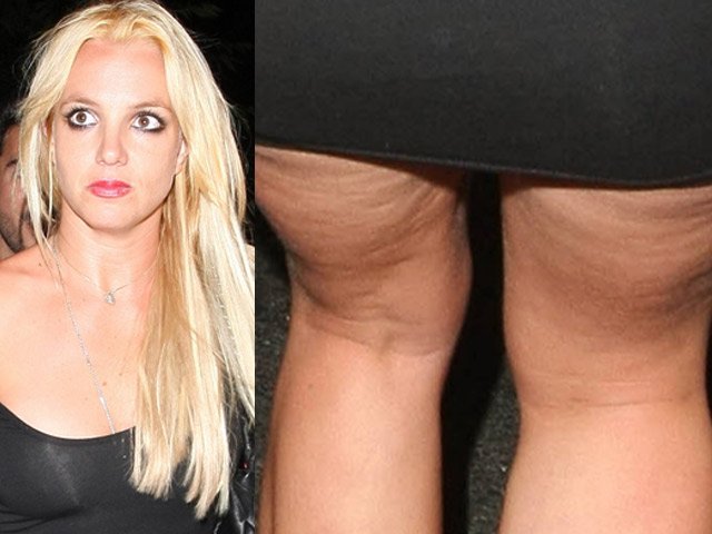 Britney Spears víctima del sobrepeso y la celulitis