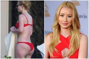 iggy_azalea_celulitis-web