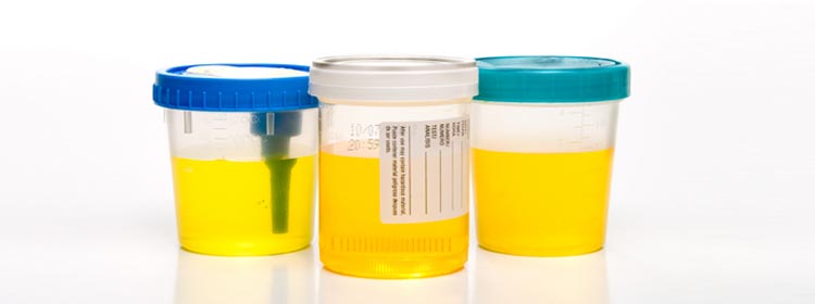 442 muestras de orina fueron recolectadas a atletas de los Juegos Centroamericanos Managua 2017