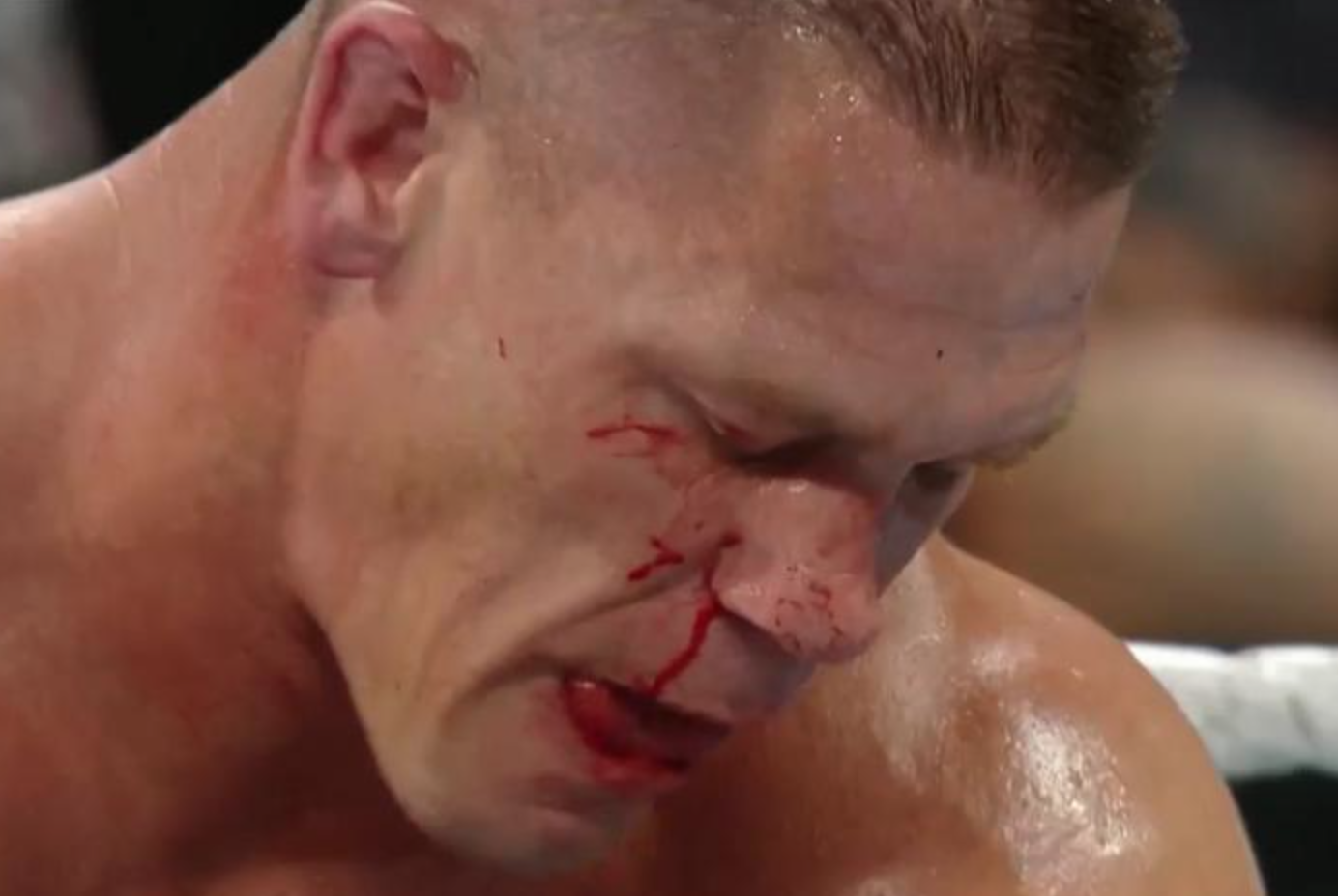 john-cena-broken-nose-wwe-raw (1)