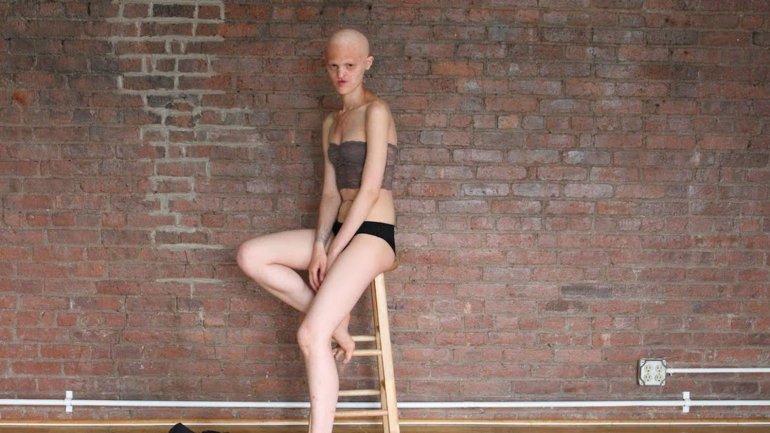 Melanie Gaydos: la modelo que desafía los estándares