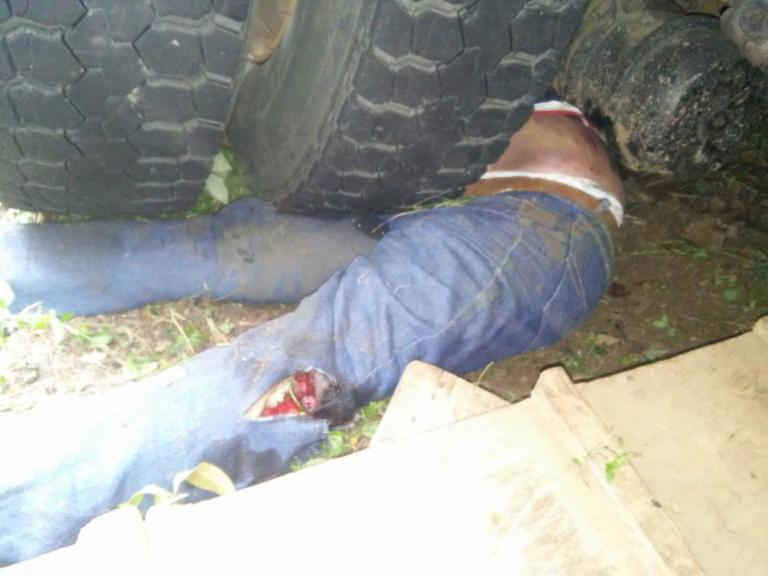 Choque entre camión y moto deja dos muertos en Chontales 