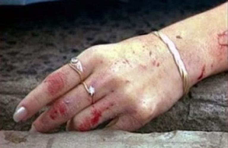 Muere en hospital chinandegana a quien marido le disparó en la cabeza y luego se suicidó