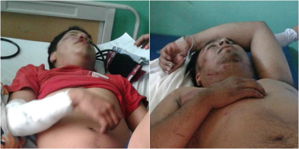 Accidente en motocicleta deja par de amigos lesionados en Jinotega