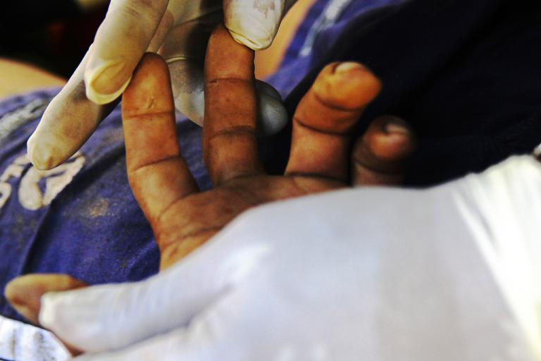 Dos trabajadores sobreviven a descomunal descarga eléctrica en Río Blanco