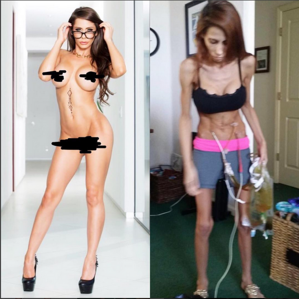 Madison ivy before and after