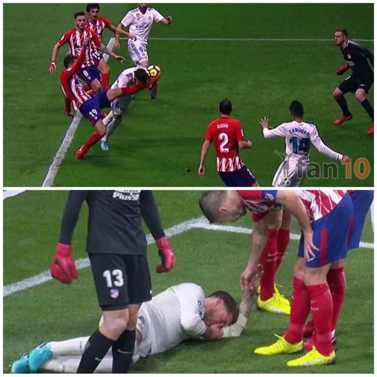 La brutal patada en el rostro que le fracturó la nariz a Sergio Ramos (+VIDEO)