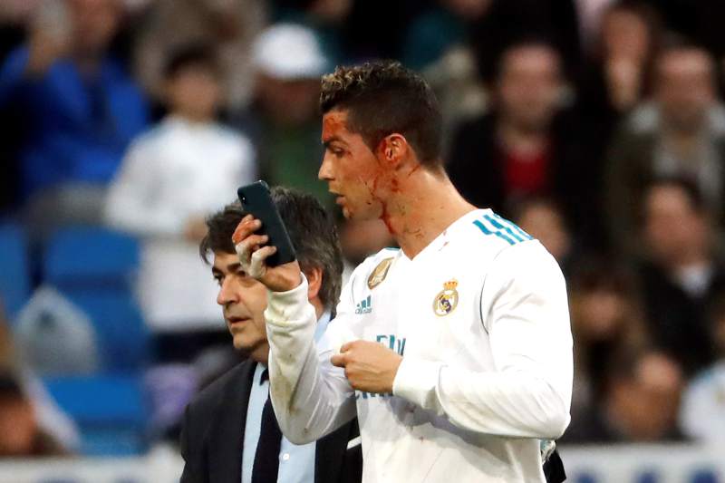 Cristiano pidió un celular para verse el rostro