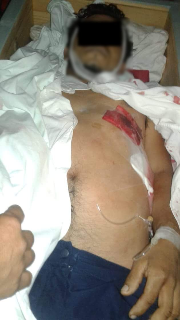 Muere Harold Antonio Zelaya a manos de desconocido en trifulca en Somoto