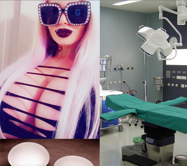 Sabrina Sabrok fue operada con éxito y pronto presumirá las nalgas más enormes del mundo