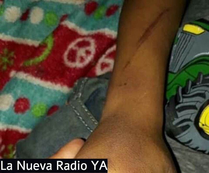 El bebé fue agredido por su papá quien estaba bajo los efectos del alcohol