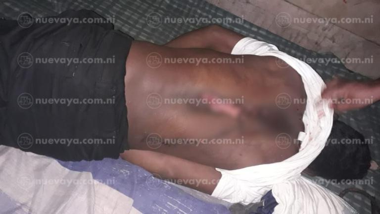 Cayuquero muere fulminado por un rayo cuando faenaba en alta mar en Bilwi