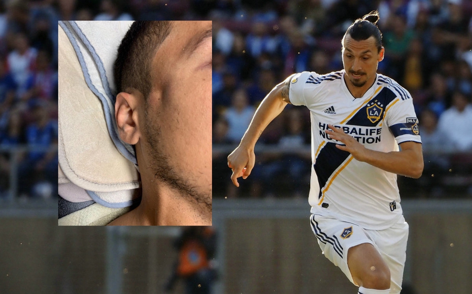 Zlatan Ibrahimovic fractura a rival mientras se jugaba el derby californiano de fútbol