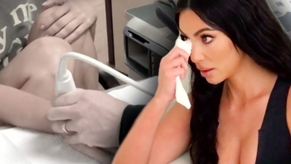 Kim Kardashian teme padecer de lupus