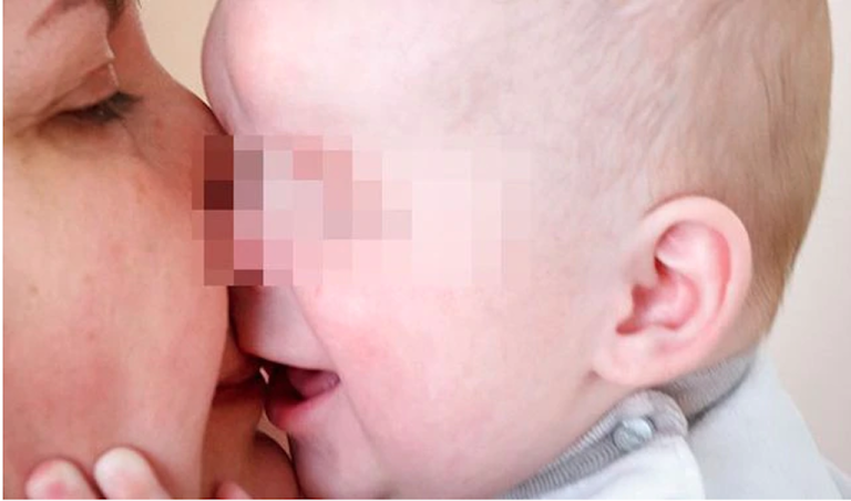 Sasha un bebé abandonado por su madre tras nacer sin ojos en Rusia