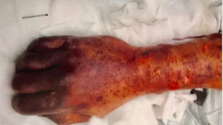 Hombre muere tras ser lamido por su perro