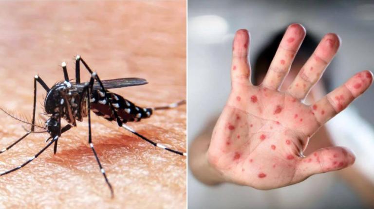 Argentina registra dos primeras muertes por dengue y sarampión en lo que va del año