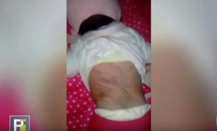 Niña golpeada por su mamá