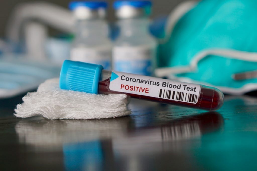 Contagiados por coronavirus