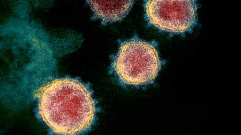 Guyana registra primer muerte por COVID-19