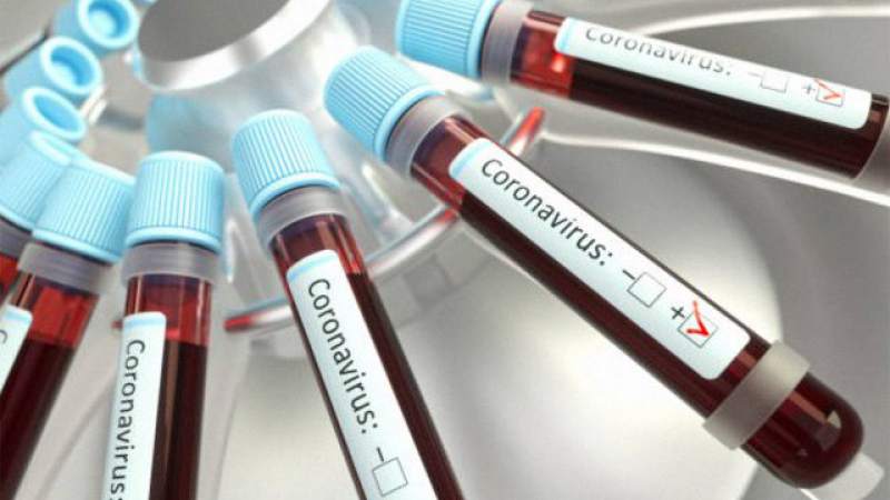  15 mil 424 nicaragüenses han vencido al coronavirus desde el inicio de la Pandemia