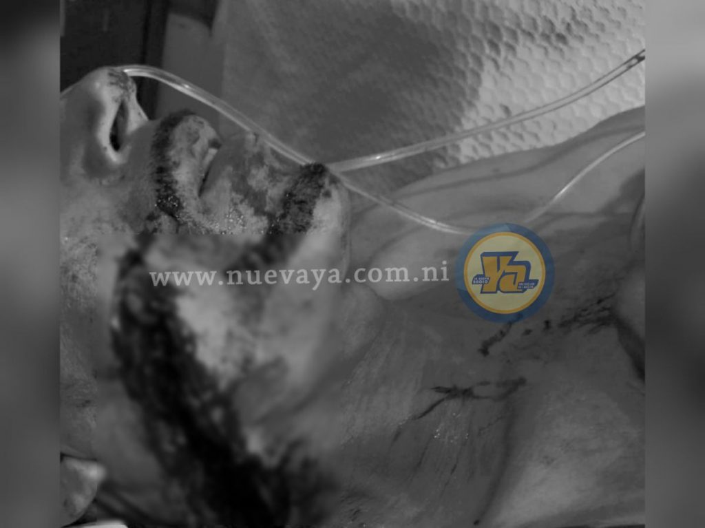 Asesinado en Jalapa