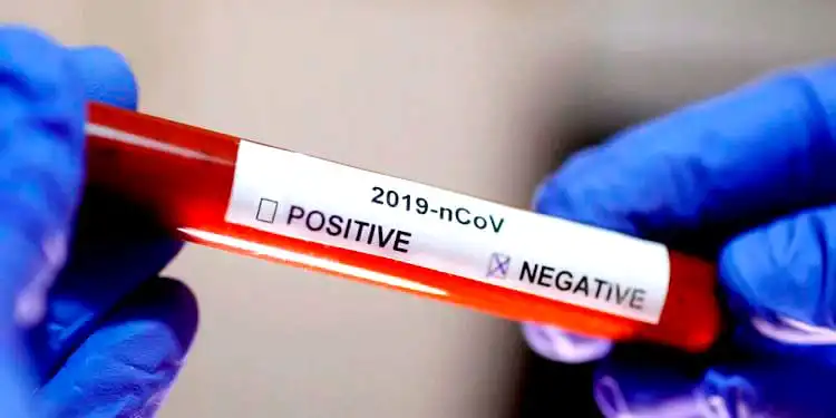 Disminuyen casos de coronavirus en Nicaragua