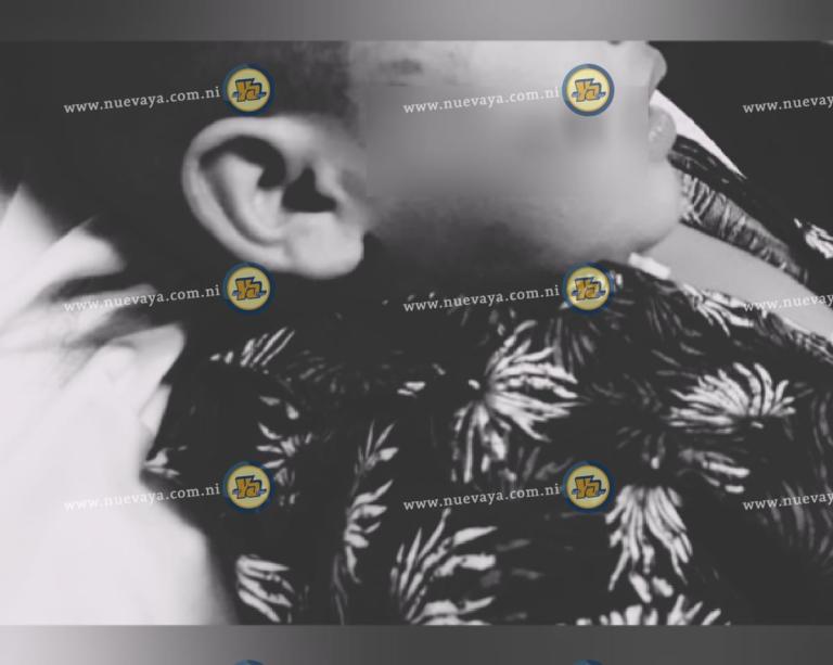 Menor escapa de las fauces de su perro pitbull en Masaya