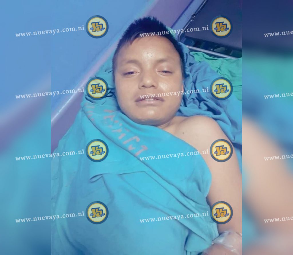 Marvin, tiene 14 años de edad, y se encuentra en el Hospital de Matagalpa