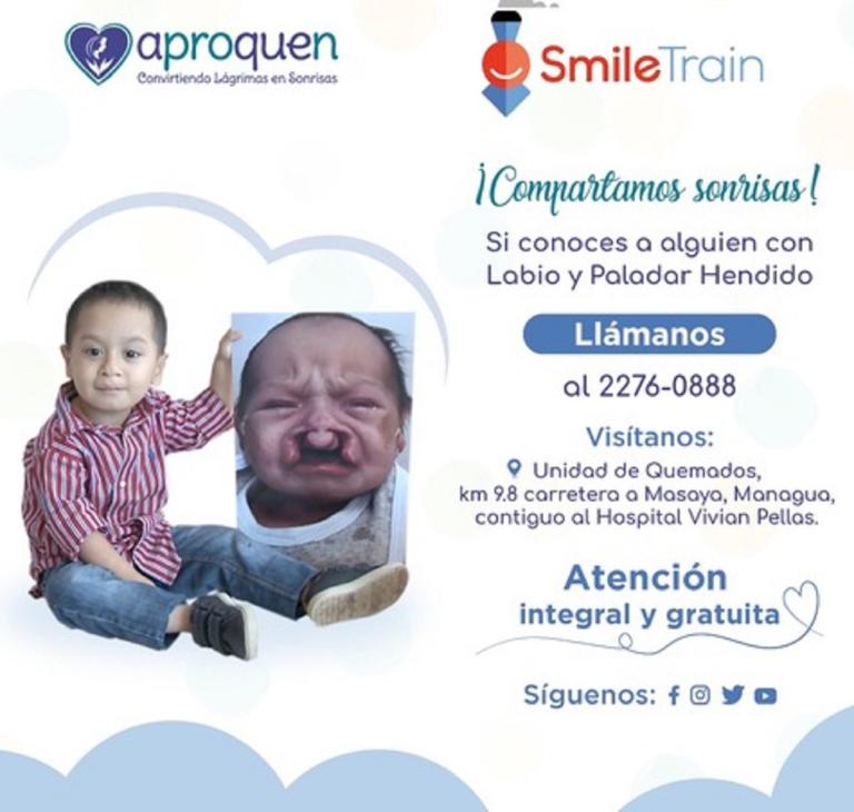 APROQUEN ofrece atención integral y gratuita a niñas  y niños con labio y paladar hendido