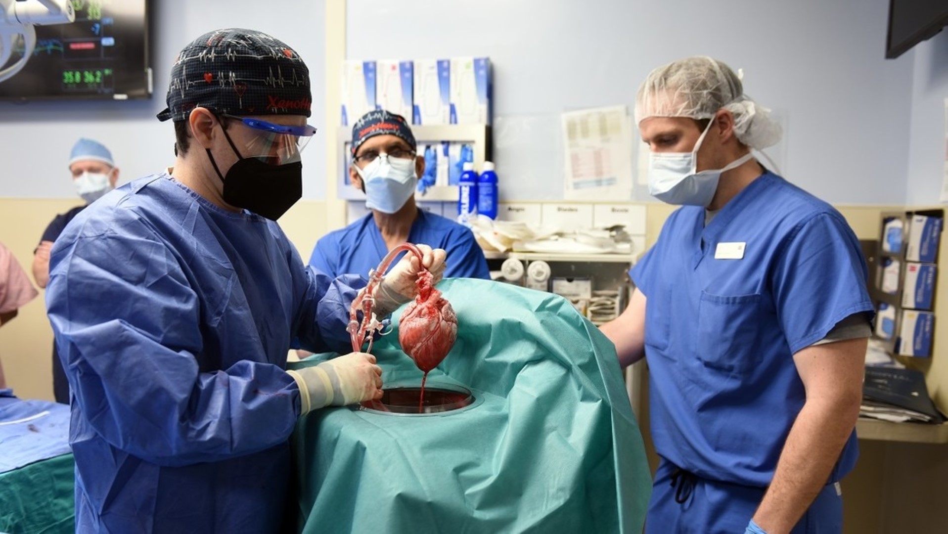 Este es el corazón de cerdo utilizado para el trasplante realizado en Baltimore, Maryland, EE.UU., el 7 de enero de 2022. Foto Mark Teske / University of Maryland School of Medicine