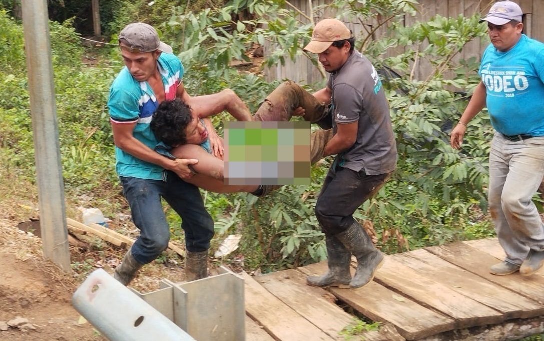 guirisero resulto gravemente lesionado en chontales