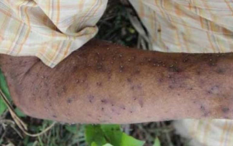 Abejas africanizadas dejan grave a un anciano en Nueva Segovia