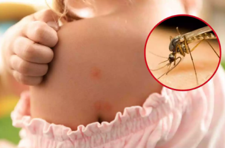 Denuncian que Estados Unidos intenta crear insectos portadores de Ébola, VIH y Hepatitis B