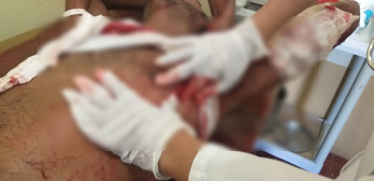 Maykel Castillo Pérez resultó gravemente herido tras ser macheteado