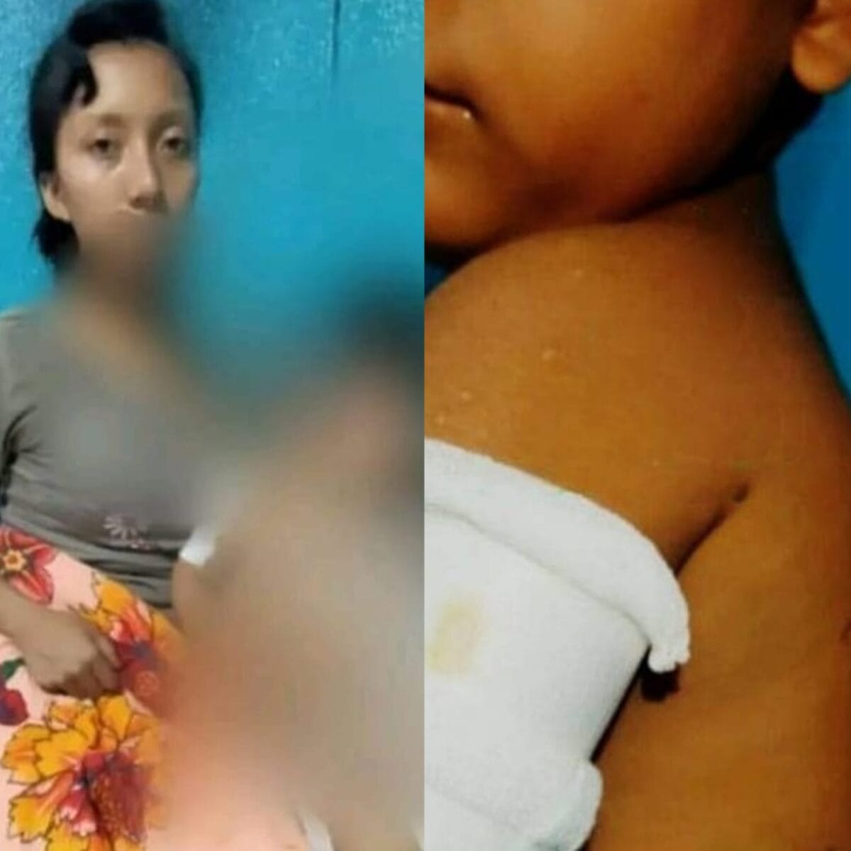 Una madre y su hijo fueron atacados por tres pitbulls en Río Blanco Matagalpa, al norte de Nicaragua