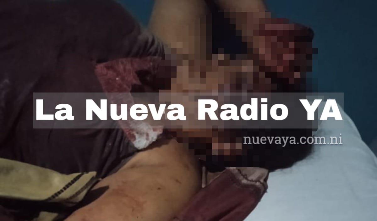María Teresa Pérez, de 35 años, fue atacada a machetazos en Río San Juan
