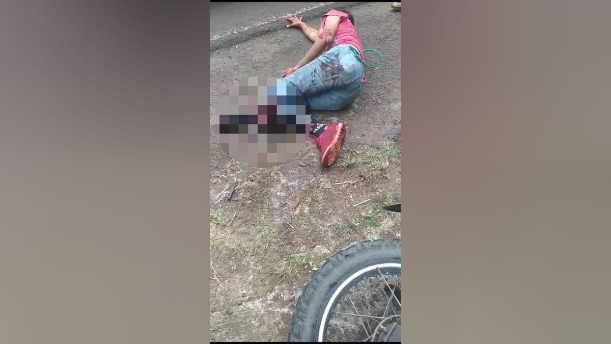 Un joven de 15 años resultó con graves lesiones en una pierna al estrellarse en moto contra un autobús en Río San Juan