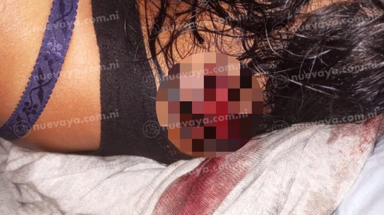 Salvaje mata a su ex porque se negó a reanudar su relación el Caribe Sur de Nicaragua