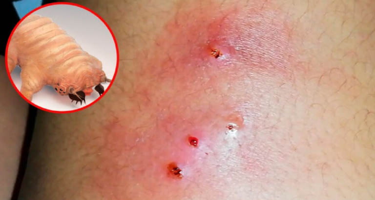 Costa Rica reporta 19 humanos infectados por el gusano barrenador