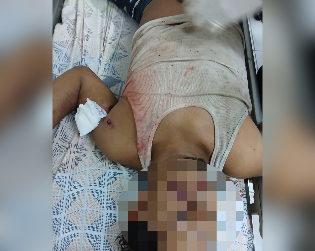 ¡Joven baleado en fiesta y atacado a balazos en Matagalpa!