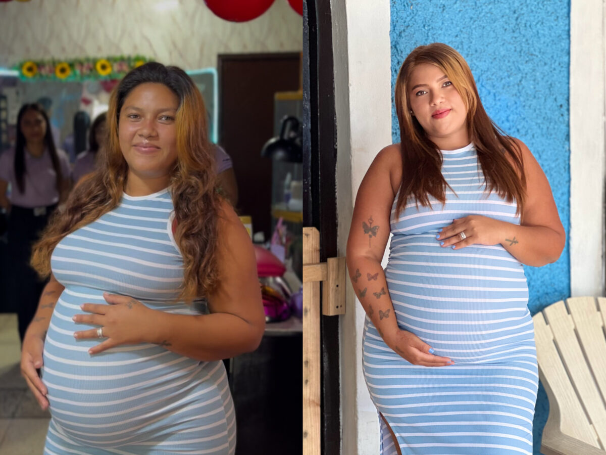 Elizabeth de los Ángeles Playa Arcia (antes y después)