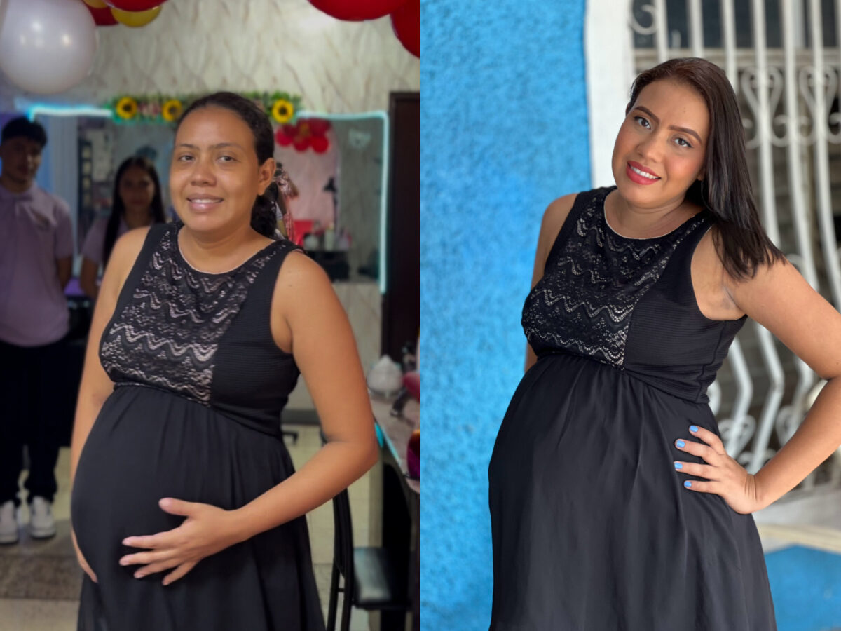 Joelia Raqurl Maltés Neyra (antes y después)