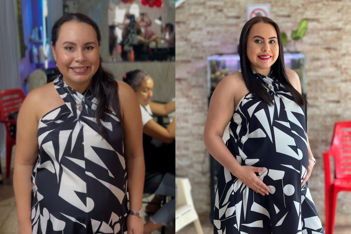 Teresa Carolina Urcuyo Pravia (antes y después)