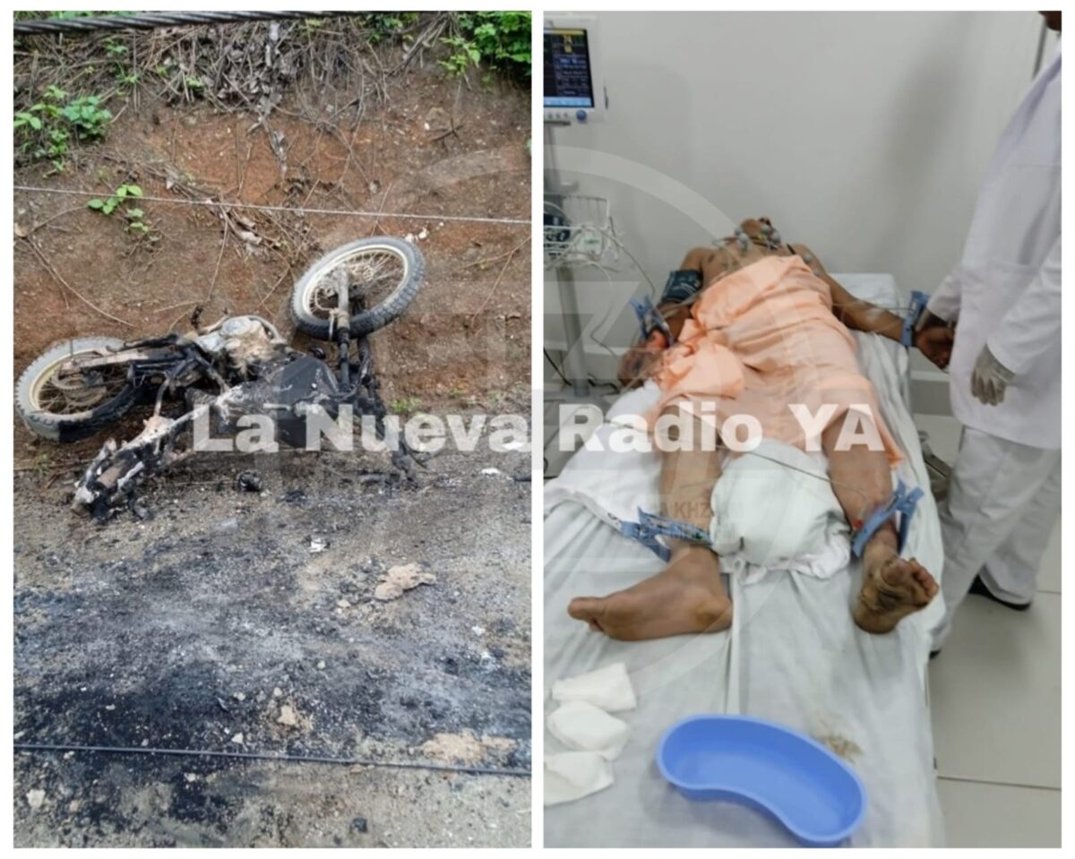 Tragedia en Quilalí: hombre sufre quemaduras de tercer grado