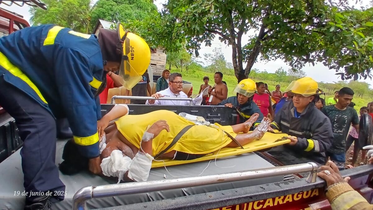 Trágico accidente: pareja sufre graves quemaduras en casa