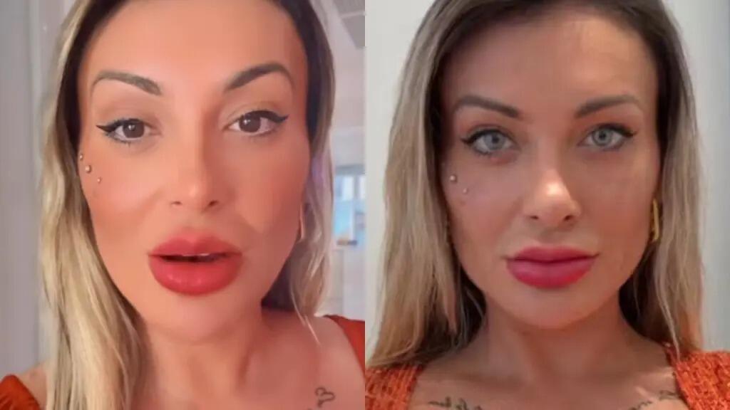 El calvario de Andressa Urach tras su cirugía ocular